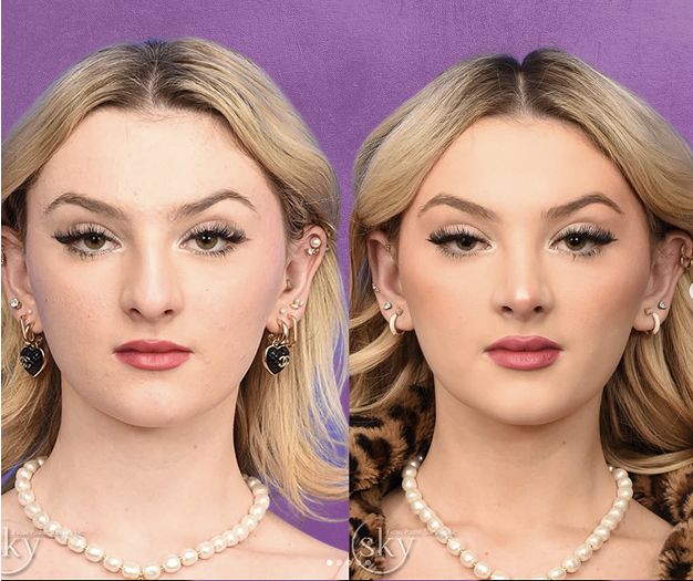 Surgeon preparing for a procedure in operating room.