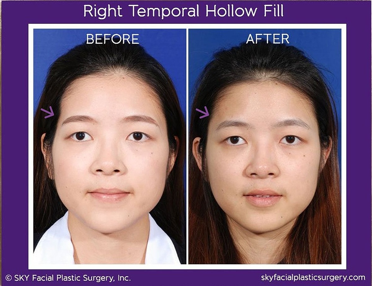 Reconstructive Surgery Before & After