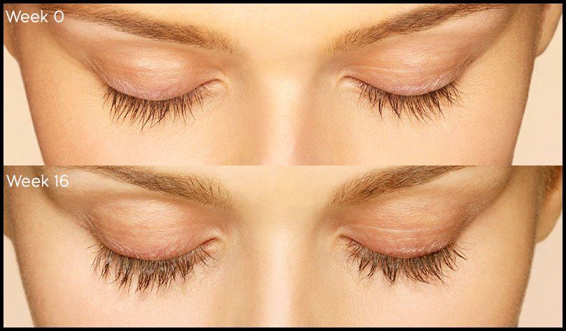 Latisse: 16 Weeks to Fuller, Longer Eyelashes